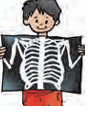 x-ray