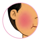 cheek