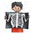 x-ray