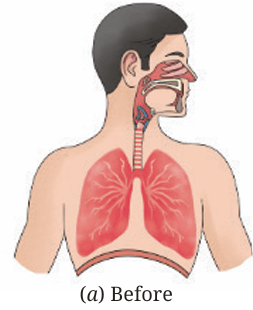 Fig.6.5(a)