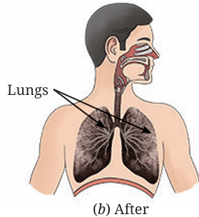 Fig.6.5(b)