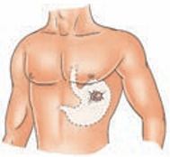 digestion
