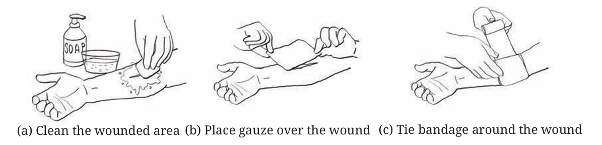 First-aid for minor wounds