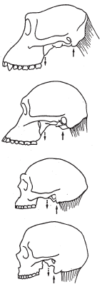 TC1-16